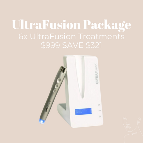 UltraFusion Package